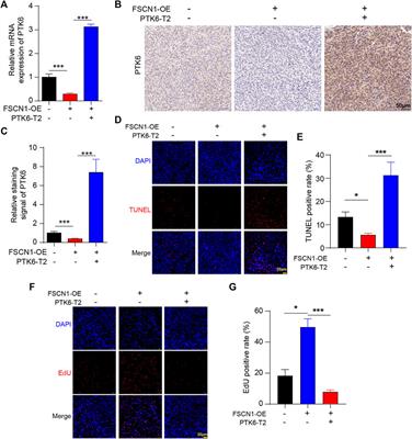 FSCN1 Promotes Esophageal Carcinoma Progression Through Downregulating PTK6 via its RNA-Binding Protein Effect